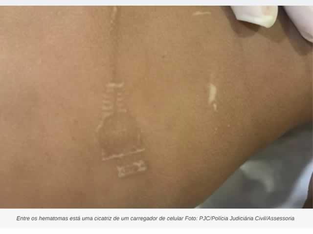 Pais são presos suspeitos de torturar e matar filho de 1 ano com socos e fio de carregador