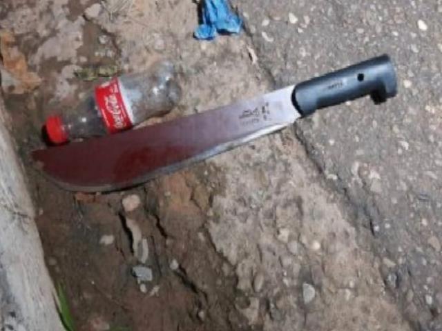 Mulher quase decepa mão do marido após ser espancada por ele no interior de MT