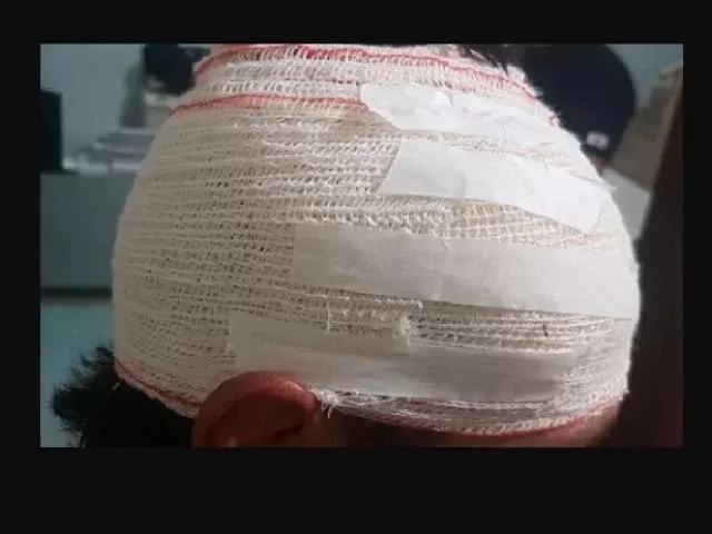 COLÍDER: Rapaz e esfaqueado na cabeça por sua conjugue enquanto estava deitado.