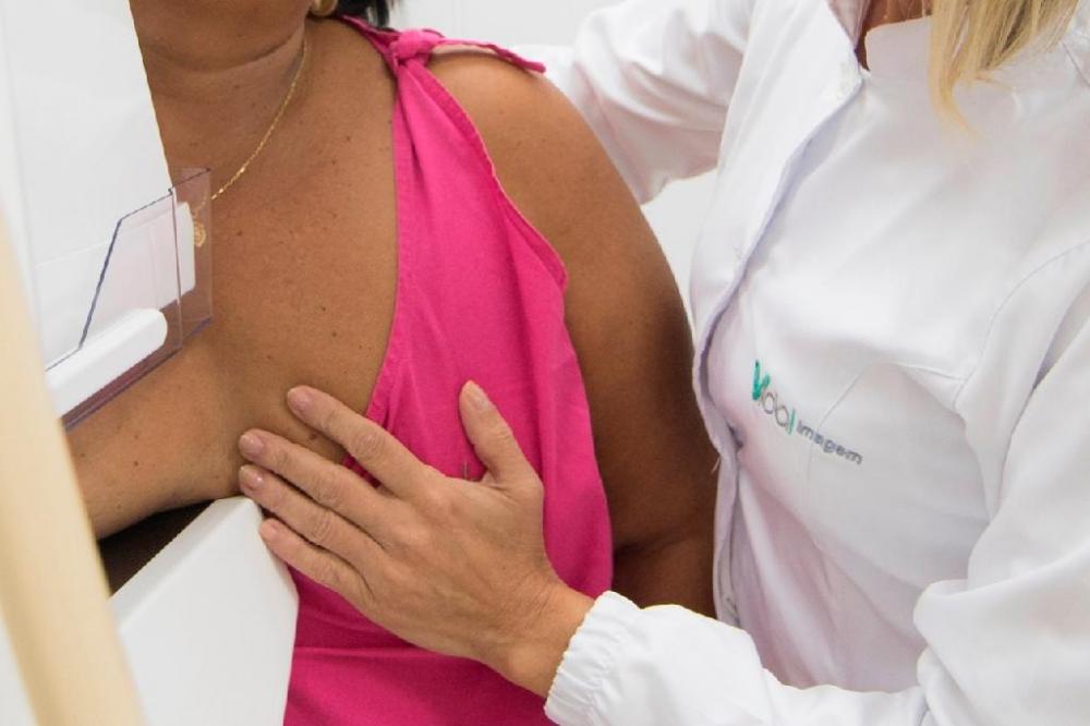 Especialistas destacam eficiência da mamografia no diagnóstico precoce do câncer de mama